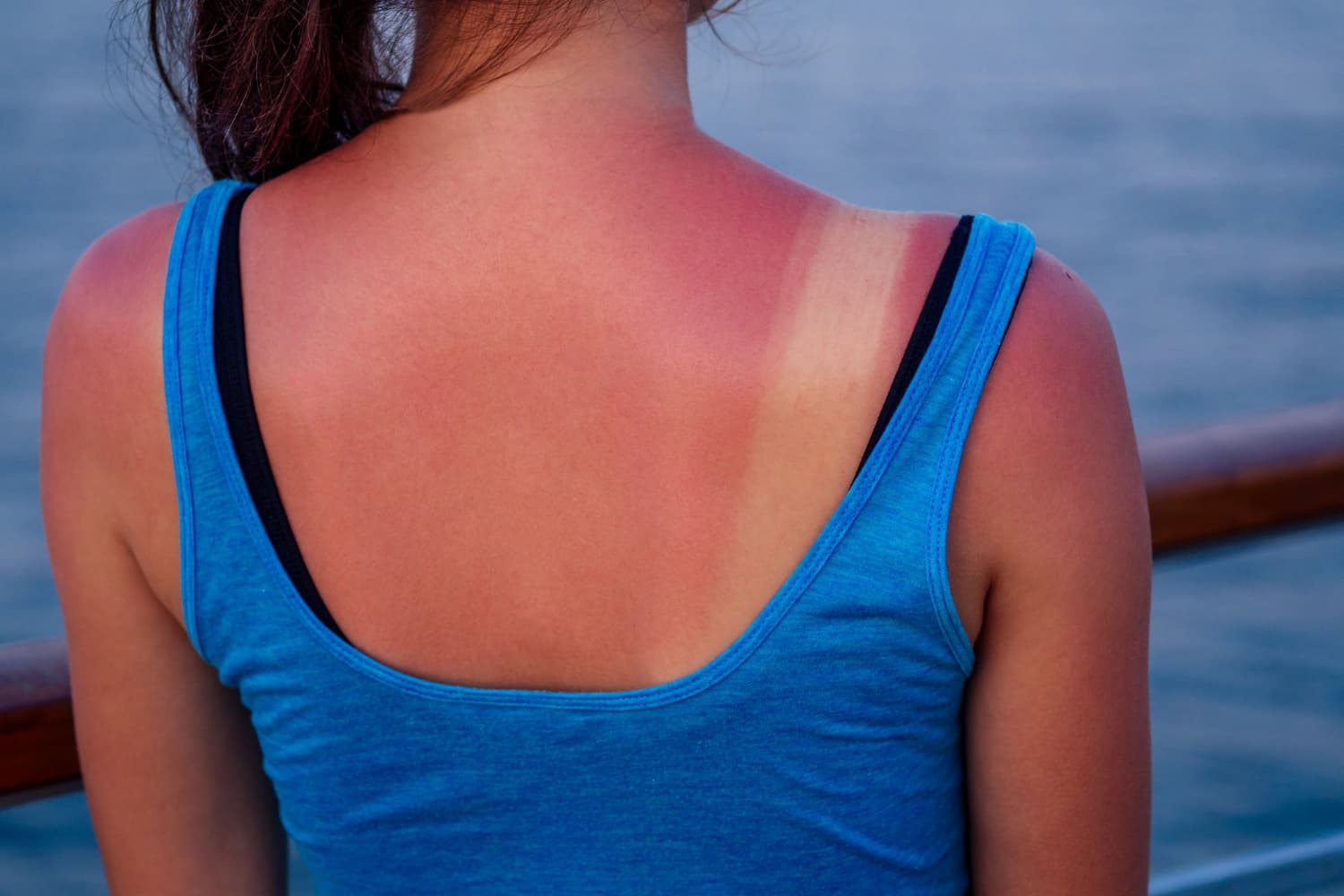 cómo sufre nuestra piel con el sol